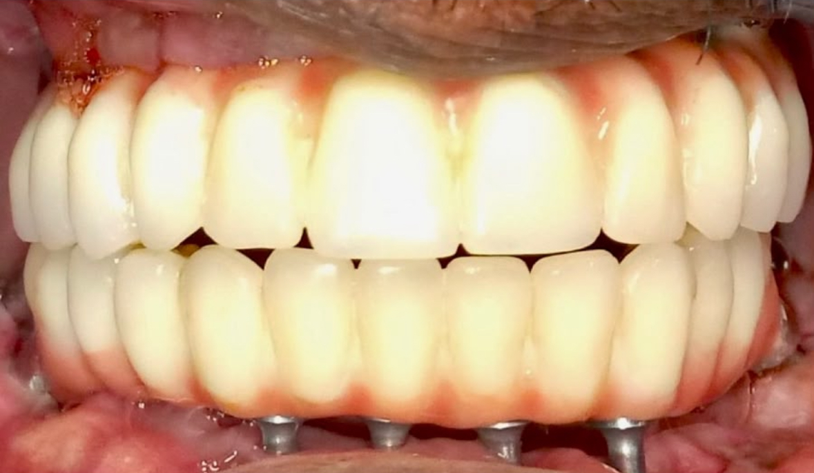 Case 1 Before