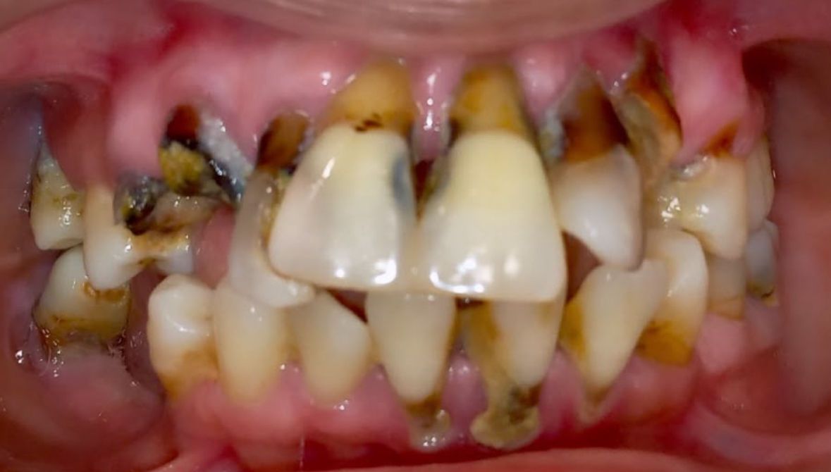 Case 2 Before