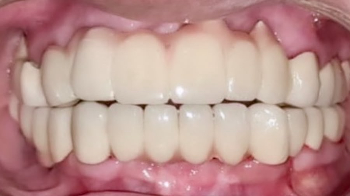 Case 2 After